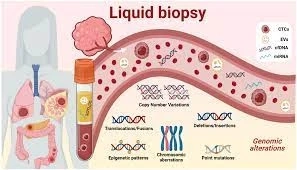 United States Liquid Biopsy Market to be Dominated by Multi-Gene Parallel Analysis Technology till 2027