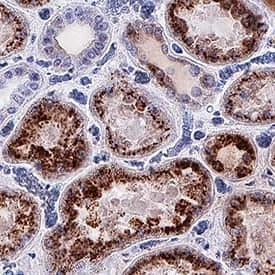 Osteopontin Antibody (OPN) Market is expected to expand at the highest CAGR By 2027