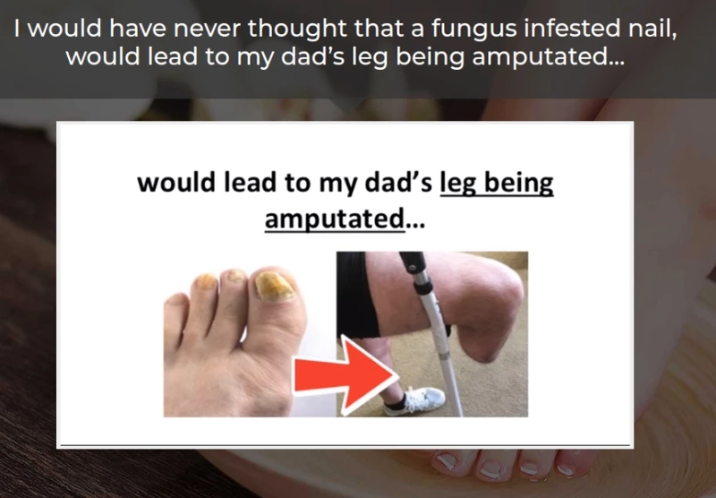 Keravita Pro Review - Flush Out Your Fungal Infection Quickly!!