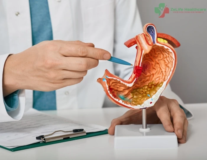 Gastroenterologist Doctor near Chandrasekharpur, Bhubaneswar – ZeLife Healthcare