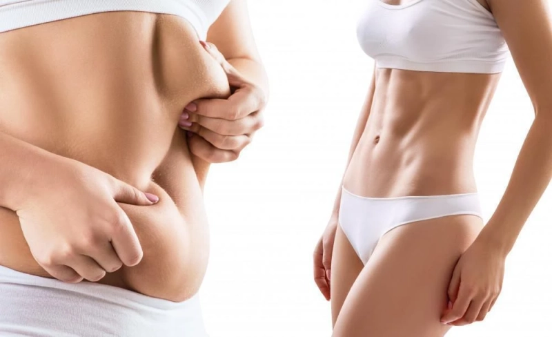 vaser liposuction in dubai