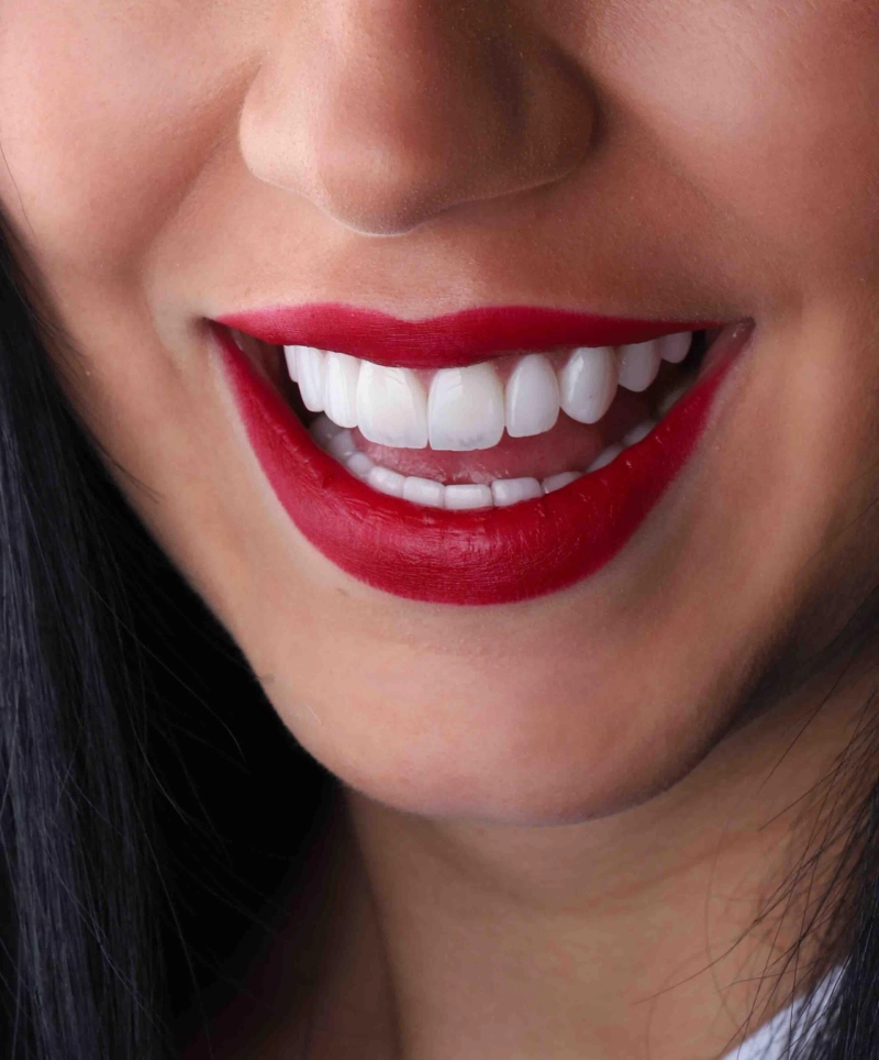 Smile You Deserve: A Guide to Cheap Dental Clinic in Dubai