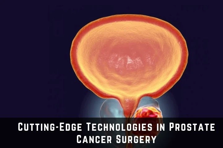Cutting-Edge Technologies in Prostate Cancer Surgery