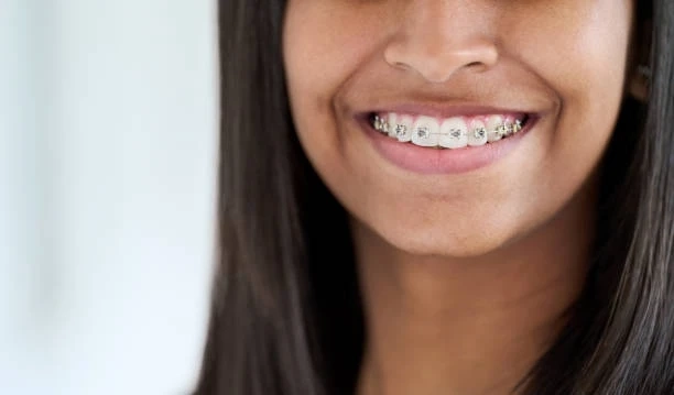 Why Southwest Portland Orthodontics Matters for Healthy, Confident Smiles