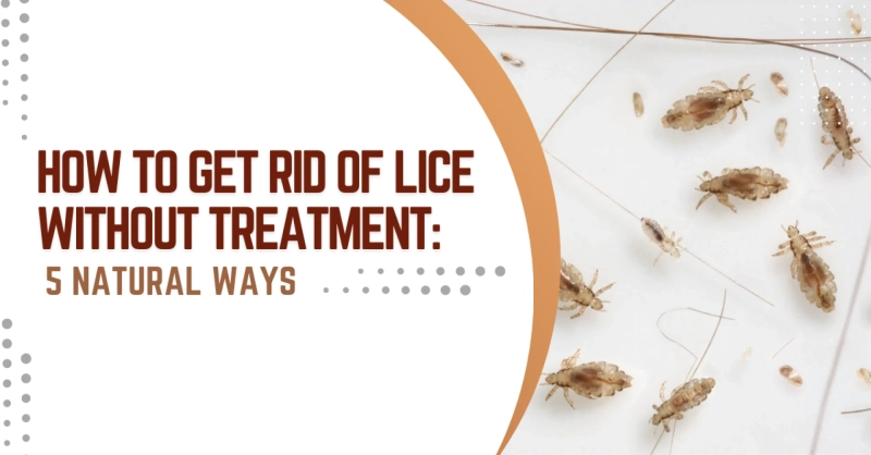 How To Get Rid Of Lice Without Treatment: 5 Natural Ways Lice