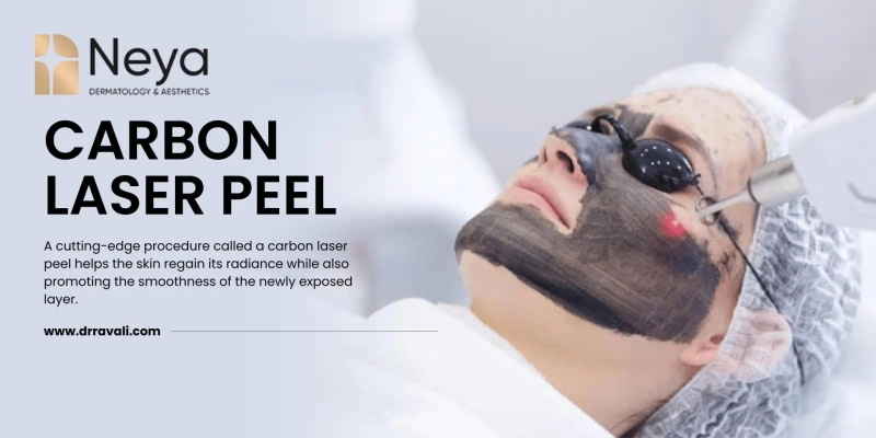 How Effective Is Carbon Laser Peel In Removing Skin Congestion?