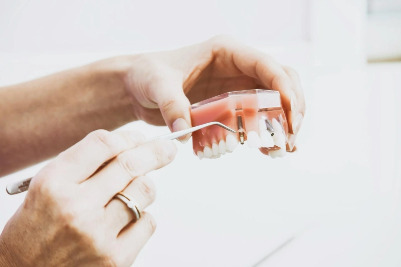 10 Signs You Need to Visit a Dentist Immediately