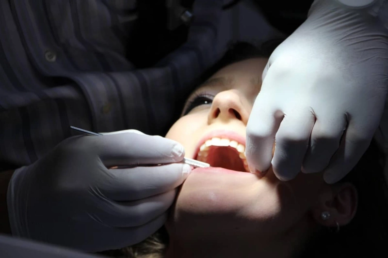 Hire Dental Experts to Remove Wisdom Teeth