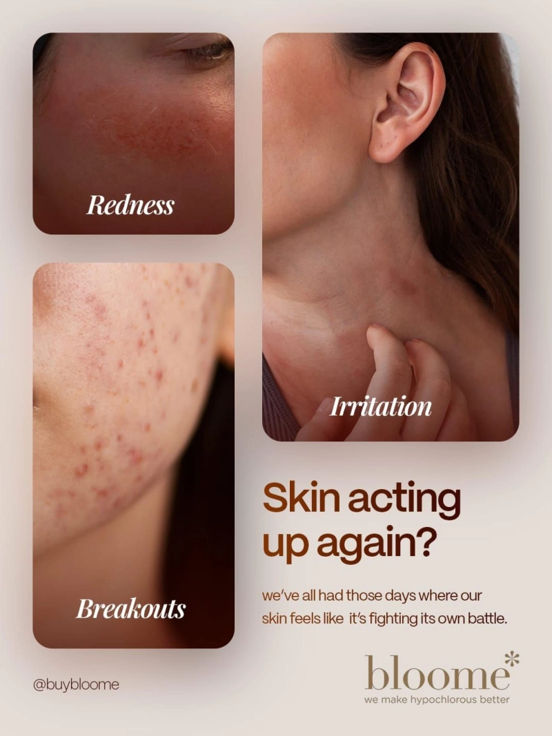 Safe Skincare for Sensitive Eyes: What You Need to Knowitle