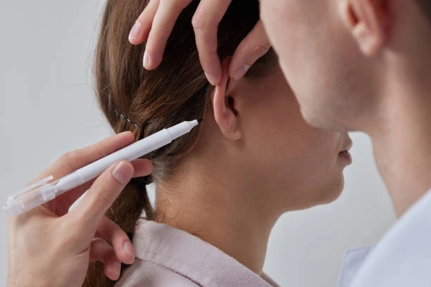 Affordable Otoplasty in Dubai: Cost and Financing Options