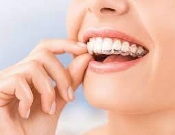 Achieving a Radiant Smile: Tooth Filling and Teeth Aligner Treatment in Gurgaon