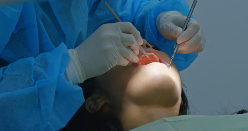 Trusted Implant Dentist in Northeast Philadelphia and Veneers Northeast Philadelphia for Confident Lasting Smiles