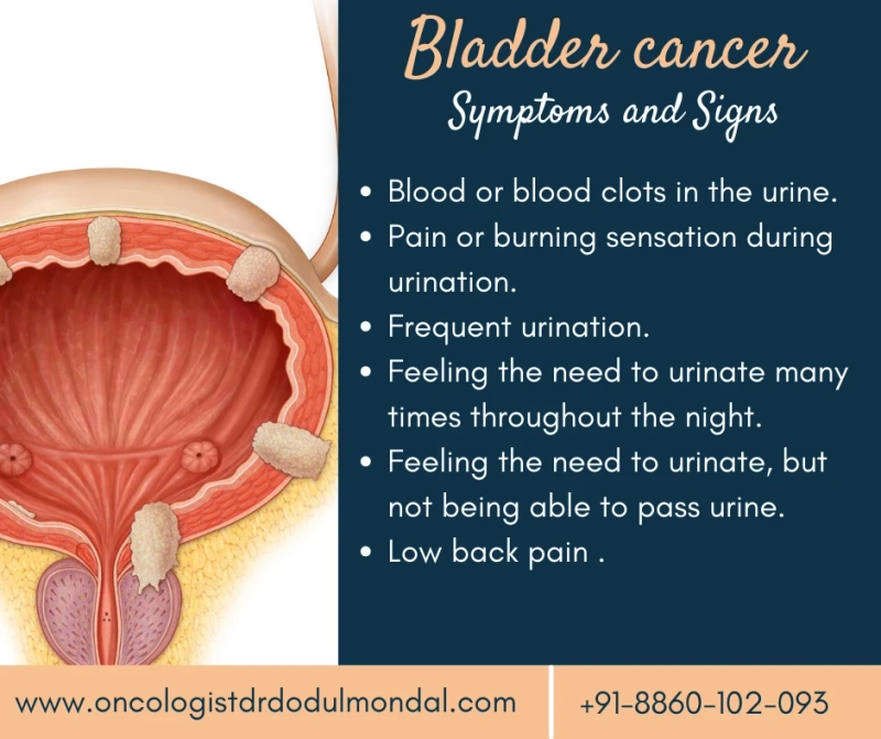 Bladder Cancer Treatment - Signs, Symptoms and Treatment Options