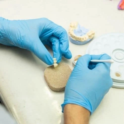 A Step By Step Guide For The Dental Implants To Be FIxed