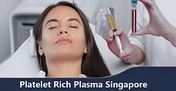 Platelet Rich Plasma (PRP) Therapy Treatment in Singapore