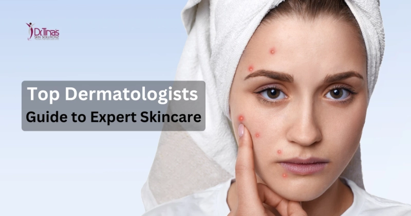 Top Dermatologists in Bangalore: Your Guide to Expert Skincare