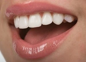 Every Thing About Cosmetic Dentistry in Toronto