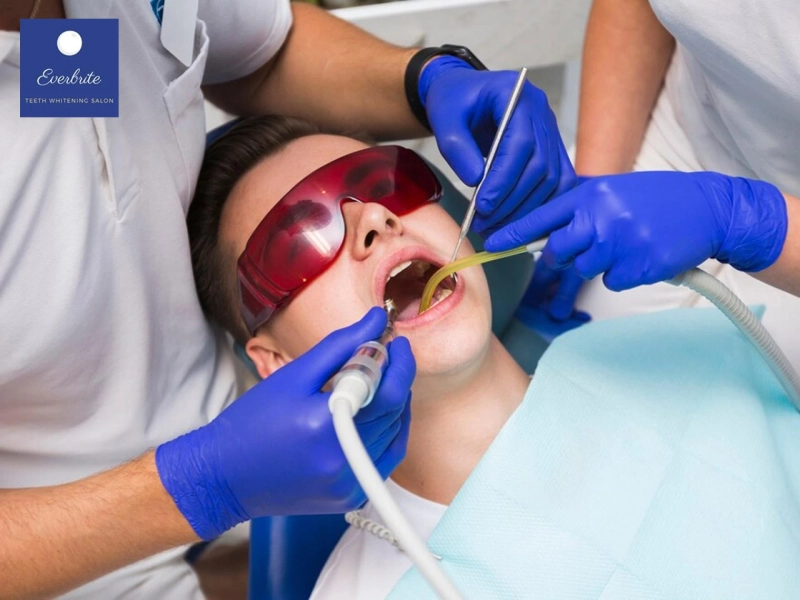 How Long Does Teeth Bleaching Last? What Affects Your Results
